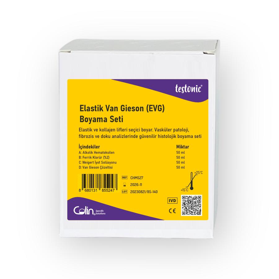 Elastic Van Gieson (EVG) Stain